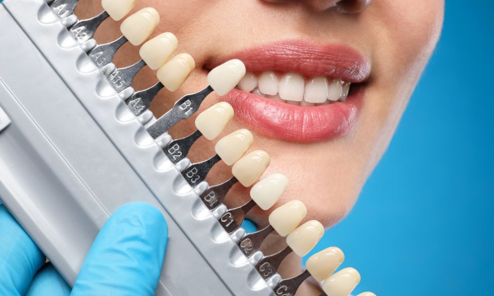 Cosmetic Dentistry